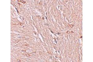 Immunohistochemical staining of human brain cells with ZBTB4 polyclonal antibody  at 2. (ZBTB4 抗体  (C-Term))