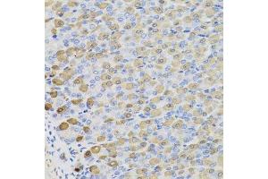 Immunohistochemistry of paraffin-embedded mouse stomach using LDHB antibody. (LDHB 抗体  (AA 1-334))