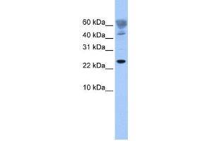 WB Suggested Anti-FUNDC1 Antibody Titration: 0. (FUNDC1 抗体  (Middle Region))