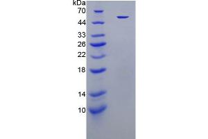 SDS-PAGE analysis of active recombinant Human ELA2. (ELANE 蛋白)