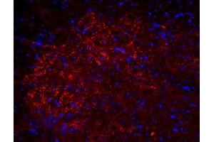 Immunohistochemistry (IHC) image for anti-Solute Carrier Family 18 (Vesicular Acetylcholine), Member 3 (SLC18A3) (AA 475-530), (C-Term) antibody (ABIN1742304)