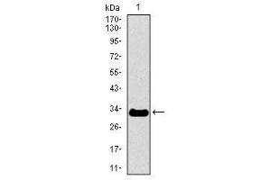 Image no. 2 for anti-Neurofilament, Heavy Polypeptide (NEFH) antibody (ABIN1491717) (NEFH 抗体)