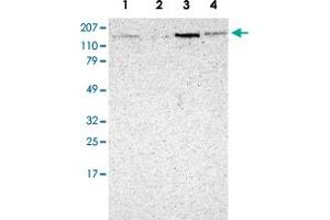 Western Blot analysis of Lane 1: RT-4, Lane 2: EFO-21, Lane 3: A-431 and Lane 4: human liver lysates with MAP3K9 polyclonal antibody . (MAP3K9 抗体)