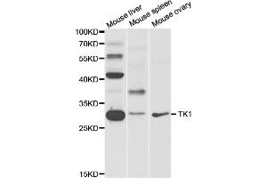 Western blot analysis of extracts of various cell lines, using TK1 antibody. (TK1 抗体)