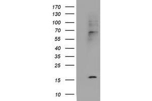 Image no. 5 for anti-Cystatin SA (CST2) antibody (ABIN1497759) (CST2 抗体)