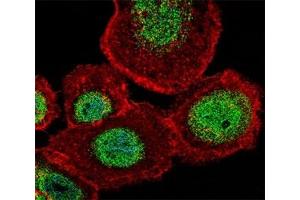 Fluorescent confocal image of A431 cell stained with LEF1 antibody at 1:25. (LEF1 抗体  (AA 10-37))