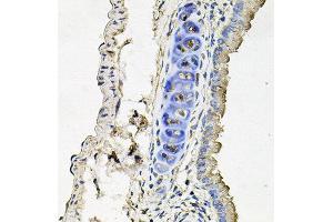 Immunohistochemistry of paraffin-embedded mouse lung using SLC39A4 antibody at dilution of 1:100 (x40 lens). (SLC39A4 抗体)