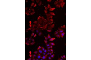 Immunofluorescence analysis of U2OS cell using PDLIM1 antibody. (PDLIM1 抗体)