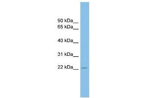 Host:  Rabbit  Target Name:  EBI3  Sample Tissue:  Human U937 Whole Cell  Antibody Dilution:  1ug/ml (EBI3 抗体  (Middle Region))