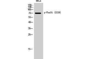 Western Blotting (WB) image for anti-Forkhead Box O1 (FOXO1) (pSer256) antibody (ABIN3172897) (FOXO1 抗体  (pSer256))