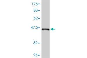 Western Blot detection against Immunogen (44 KDa) . (STK32A 抗体  (AA 1-166))