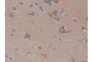 Detection of DKK3 in Human Brain Tissue using Polyclonal Antibody to Dickkopf Related Protein 3 (DKK3) (DKK3 抗体  (AA 22-350))