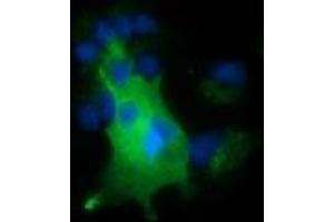 Anti-NUMB mouse monoclonal antibody (ABIN2453393) immunofluorescent staining of COS7 cells transiently transfected by pCMV6-ENTRY NUMB (RC216230). (NUMB 抗体)