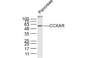 Lane 1: Mouse pancreas lysates probed with Anti CCKAR Polyclonal Antibody, Unconjugated (bs-11514R) at 1:300 overnight at 4˚C. (CCKAR 抗体  (AA 161-200))
