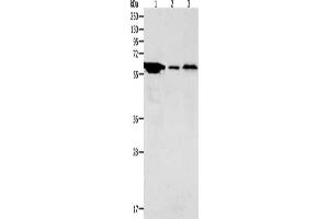 Gel: 10 % SDS-PAGE, Lysate: 40 μg, Lane 1-3: Hela cells, Mouse stomach tissue, Mouse brain tissue, Primary antibody: ABIN7189672(ADCYAP1R1 Antibody) at dilution 1/2000, Secondary antibody: Goat anti rabbit IgG at 1/8000 dilution, Exposure time: 5 minutes (ADCYAP1R1 抗体)