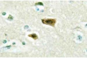Immunohistochemistry (IHC) analyzes of LUCA15 antibody in paraffin-embedded human brain tissue. (RBM5 抗体)