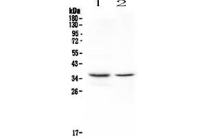 Western blot analysis of CD8 alpha using anti-CD8 alpha antibody . (CD8 alpha 抗体  (AA 28-196))