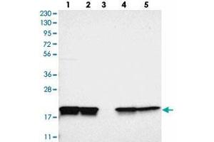 Western blot analysis of Lane 1: RT-4, Lane 2: U-251 MG, Lane 3: Human Plasma, Lane 4: Liver, Lane 5: Tonsil with PPIB polyclonal antibody . (PPIB 抗体)