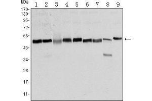 Western blot analysis using FOXD3 mouse mAb against NTERA-2 (1), HUVE-12 (2), HEK293 (3), Hela (4), Jurkat (5), K562 (6), RAW264. (FOXD3 抗体)