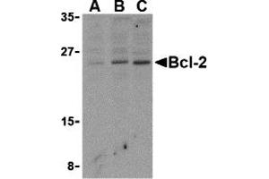 Western Blotting (WB) image for anti-B-Cell CLL/lymphoma 2 (BCL2) (N-Term) antibody (ABIN1031266) (Bcl-2 抗体  (N-Term))
