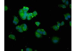 Immunofluorescence staining of MCF-7 cells with ABIN7143943 at 1:100, counter-stained with DAPI. (SNCA 抗体  (AA 1-140))