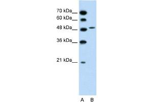 WB Suggested Anti-SLC10A5 Antibody Titration:  1. (SLC10A5 抗体  (C-Term))