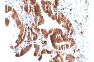 Formalin-fixed, paraffin-embedded human Gallbladder stained with Topo I, MT Mouse Monoclonal Antibody (TOP1MT/488). (TOP1MT 抗体)
