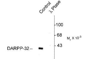 Western blots of rat caudate lysate showing specific immunolabeling of the ~32k DARPP-32 phosphorylated at Thr75 (Control). (DARPP32 抗体  (pThr75))