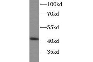WB analysis of HeLa cells subjected to SDS-PAGE, using SPOP antibody (1/500 dilution). (SPOP-B 抗体)