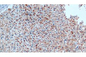 Detection of CTSD in Human Liver Tissue using Monoclonal Antibody to Cathepsin D (CTSD)