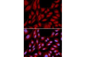 Immunofluorescence analysis of U2OS cell using BAG1 antibody. (BAG1 抗体  (AA 1-230))