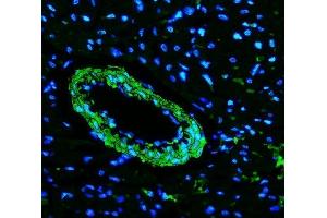 IF analysis of TAGLN/Transgelin using anti-TAGLN/Transgelin antibody (ABIN7600099). (Transgelin 抗体  (AA 15-170))