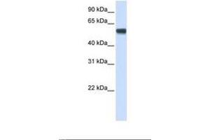 Image no. 1 for anti-Splicing Factor 3a, Subunit 3, 60kDa (SF3A3) (AA 341-390) antibody (ABIN6737944)