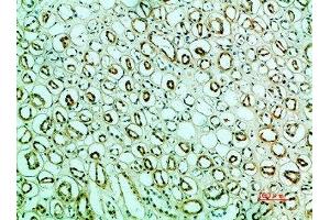 Immunohistochemical analysis of paraffin-embedded human-kidney, antibody was diluted at 1:200 (IRF3 抗体  (AA 1268-1341))