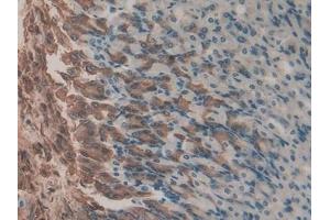 Immunohistochemistry (IHC) image for anti-Gastrokine 2 (GKN2) (AA 21-184) antibody (ABIN7437656)