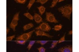 Immunofluorescence analysis of L929 cells using PREPL Polyclonal Antibody at dilution of 1:100 (40x lens). (PREPL 抗体)