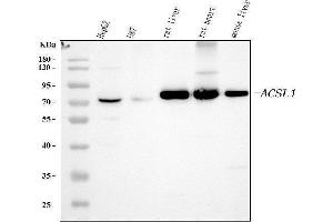 Western blot analysis of ACSL1 using anti-ACSL1 antibody (ABIN4886418). (ACSL1 抗体  (AA 604-698))