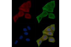 ABIN7096184 and ABIN7100246 staining Hela cells(30 min of UV treatment) by IF/ICC.