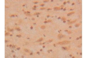 Immunohistochemistry (IHC) image for anti-Superoxide Dismutase 1, Soluble (SOD1) (AA 2-154) antibody (ABIN7429214)