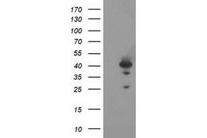 HEK293T cells were transfected with the pCMV6-ENTRY control (Left lane) or pCMV6-ENTRY RAD51L1 (Right lane) cDNA for 48 hrs and lysed. (RAD51 Homolog B 抗体  (AA 119-346))