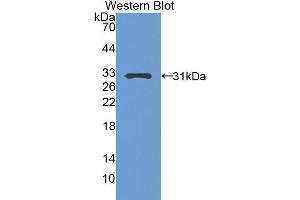 Western Blotting (WB) image for anti-Pregnancy-Associated Plasma Protein A, Pappalysin 1 (PAPPA) (AA 244-501) antibody (ABIN1860125) (PAPPA 抗体  (AA 244-501))