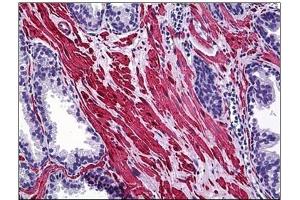 Immunohistochemistry (IHC) image for anti-SMAD Specific E3 Ubiquitin Protein Ligase 1 (SMURF1) antibody (ABIN781919) (SMURF1 抗体)
