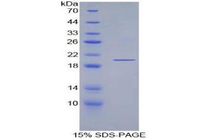 SDS-PAGE analysis of ECP Protein. (Ecotin 蛋白)
