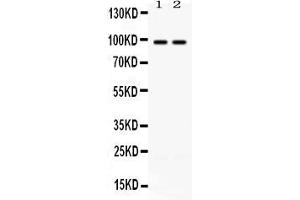Western blot analysis of ABR expression in rat brain extract ( Lane 1) and mouse brain extract ( Lane 2). (ABR 抗体  (Middle Region))