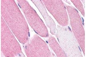 Immunohistochemistry (Formalin/PFA-fixed paraffin-embedded sections) of human skeletal muscle tissue with BEST3 polyclonal antibody . (Bestrophin 3 抗体  (Internal Region))