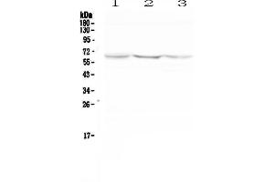 Western blot analysis of NOX2 using anti-NOX2 antibody . (CYBB 抗体  (AA 416-500))