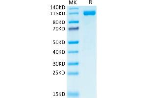 Human CD31 on Tris-Bis PAGE under reduced condition.