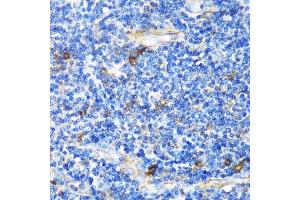 Immunohistochemistry of paraffin-embedded Human tonsil using PTCH1 antibody (ABIN1682368, ABIN1682367, ABIN3015342, ABIN3015343 and ABIN6213997) at dilution of 1:100 (40x lens). (Patched 1 抗体  (AA 1214-1312))