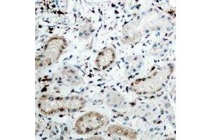 Immunohistochemical analysis of DCP1A staining in human kidney formalin fixed paraffin embedded tissue section. (DCP1A 抗体)
