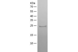 Western Blotting (WB) image for Interleukin 22 Receptor, alpha 2 (IL22RA2) (AA 22-231) protein (His tag) (ABIN7123577) (IL22RA2 Protein (AA 22-231) (His tag))